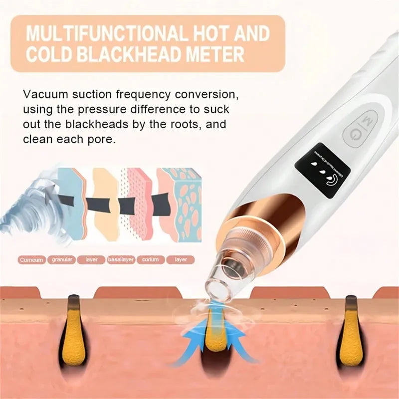 Limpiador de Puntos Negros con Calor y Frío | Aspirador Facial Eléctrico Recargable USB
