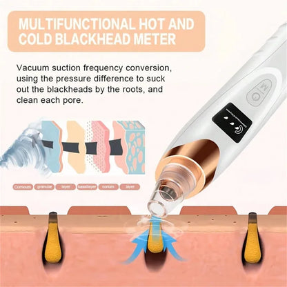 Limpiador de Puntos Negros con Calor y Frío | Aspirador Facial Eléctrico Recargable USB
