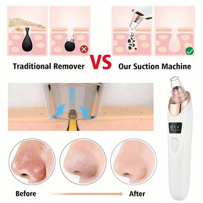 Limpiador de Puntos Negros con Calor y Frío | Aspirador Facial Eléctrico Recargable USB